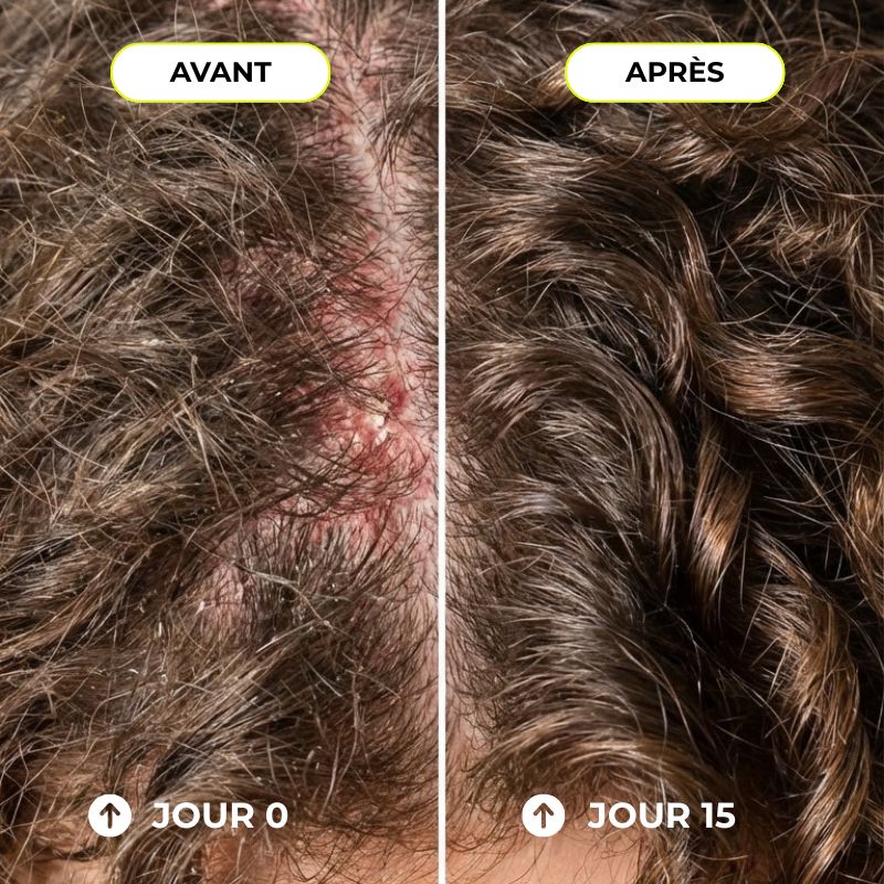 Shampoing crème - Nettoie & anti-pelliculaire