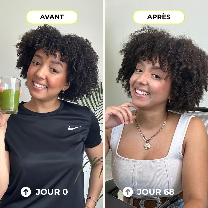 Sérum - Croissance et fortification